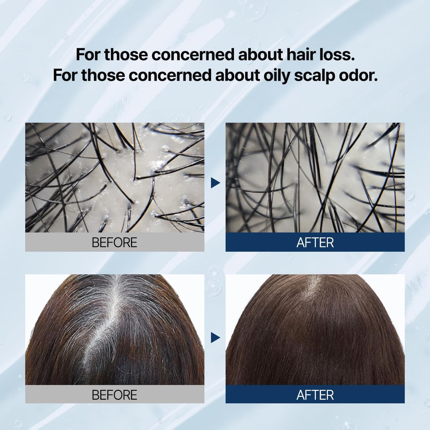 Anti Hair Loss Fast Care Hair Shampoo