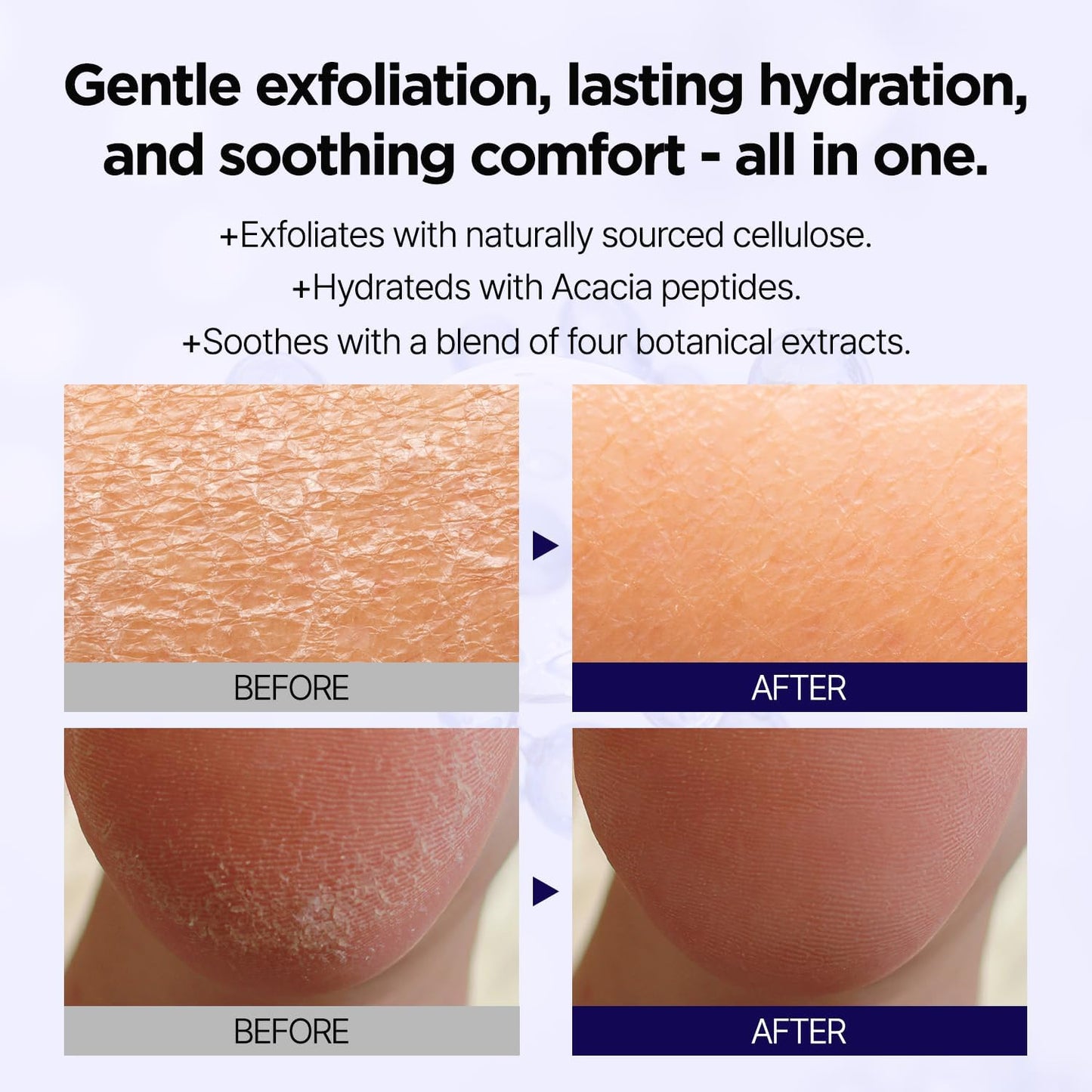 PONG DANG Deep Clean Soft Peeling Gel