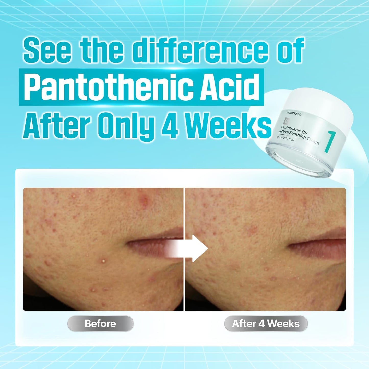 Numbuzin No.1 Pantothenic B5 Active Soothing Cream