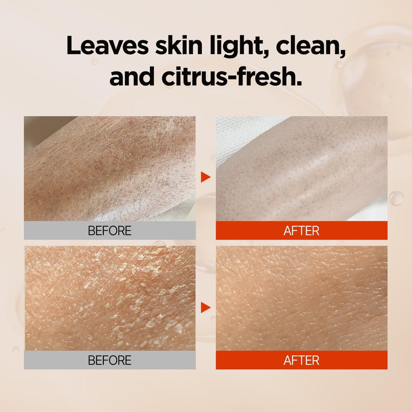 PONGDANG Triple Action A.C. Care Body Cleanser