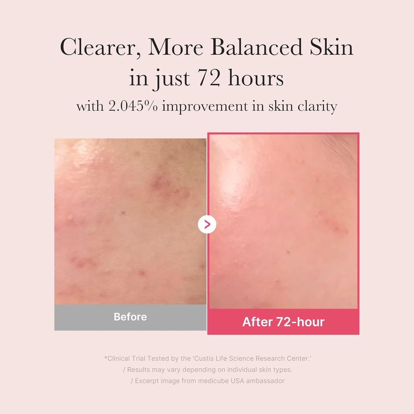 Medicube+ TXA Niacinamide 15 Serum (30ml)
