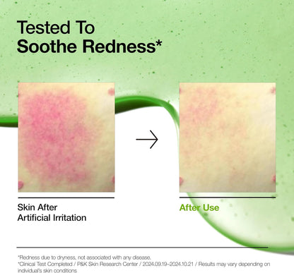 Anua - Azelaic Acid 10 Hyaluron Redness Soothing Serum 30ml