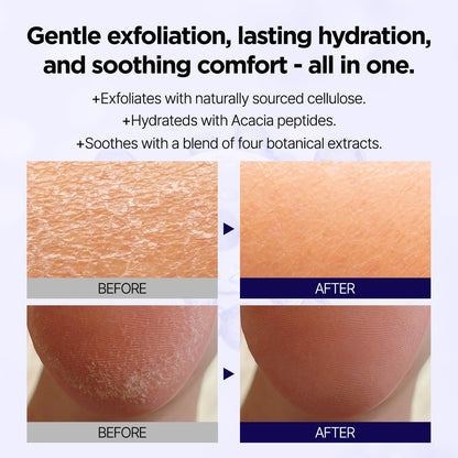PONG DANG Deep Clean Soft Peeling Gel