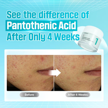 Numbuzin No.1 Pantothenic B5 Active Soothing Cream