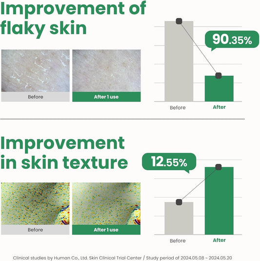 AXIS-Y PHA Resurfacing Glow Peel